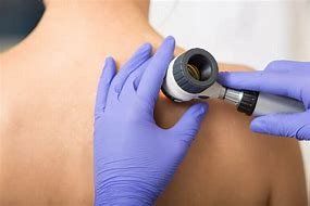 Check For Signs Of Skin Cancer 1711607695
