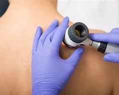 Check For Signs Of Skin Cancer 1711607695