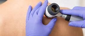 Check For Signs Of Skin Cancer 1711607695